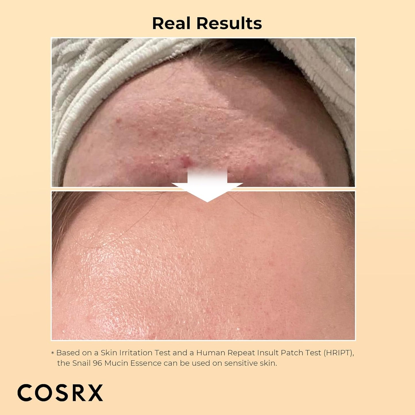 COSRX Duo- Snail 92 Cream & Snail 96 Essence, Daily Face Gel Moisturizer and Hydrating Serum for Face with Snail Secretion Filtrate