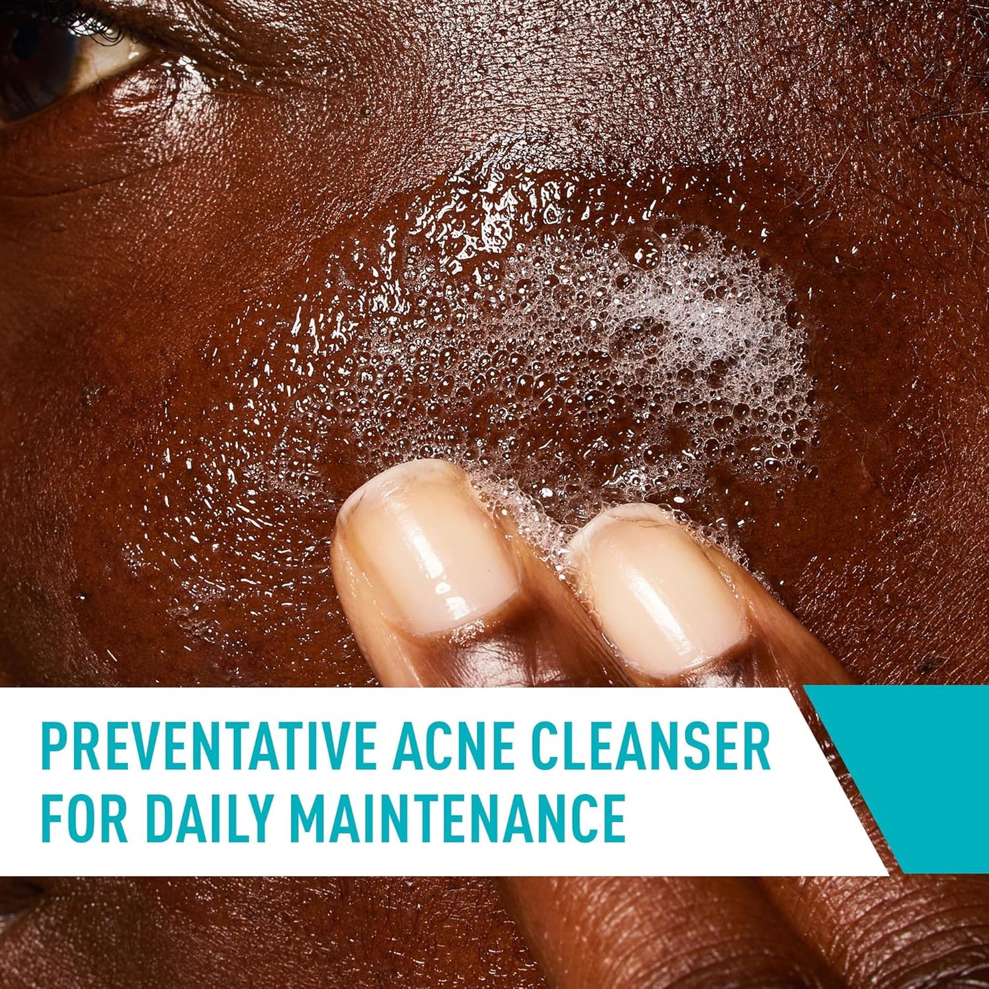 CeraVe Acne Control Cleanser 16 oz